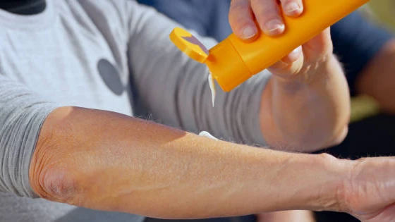 A woman's arm as she squeezes white sunscreen from an orange tube onto her hand for skin protection outdoors